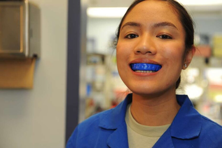 How Do Dental Labs Create Mouthguards?