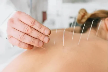 How Acupuncture Can Complement Other Forms of Pain Relief