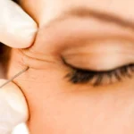 Understanding the Different Types of Botox Treatments Available