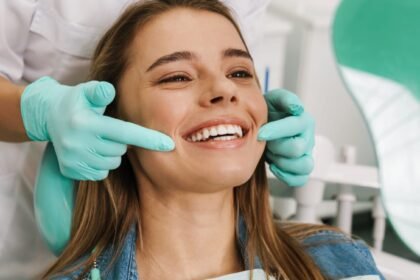 4 Benefits of Dental Veneers