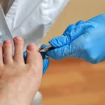 4 Treatments in Podiatry for Common Foot Disorders