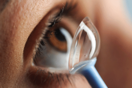 5 Things to Know About Contact Lens Fittings