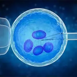 Can You Combine In Vitro Fertilization With Other Procedures?