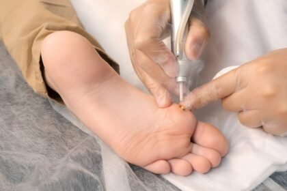 Common Conditions Treated by Podiatric Medicine