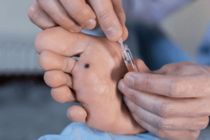 Effective Treatments for Warts
