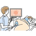 FAQs About Colonoscopies