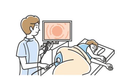 FAQs About Colonoscopies
