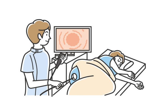 FAQs About Colonoscopies