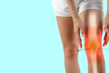 FAQs About Knee Surgery