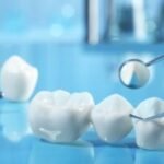 How To Fix Missing Teeth