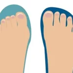 How to Prevent Foot Pain with Proper Footwear