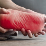 Neuropathy and Foot Pain: Causes, Symptoms, and Treatments