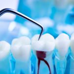 Pediatric Dentistry: Preventative Care Tips
