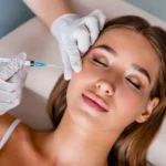 What To Expect at a Microneedling Appointment