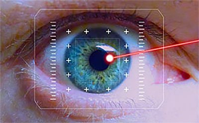Aftercare Tips Following LASIK Surgery