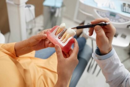 How Dental Implants Can Enhance Your Smile and Self-confidence