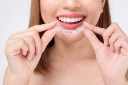 The Advantages of Invisalign Over Conventional Braces