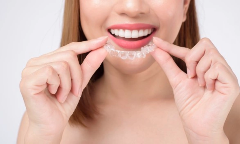 The Advantages of Invisalign Over Conventional Braces