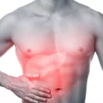 The Connection Between Diet and Gallbladder Health