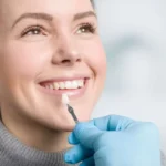 The Role of Veneers and Crowns in Cosmetic Dentistry