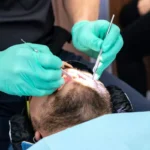 Understanding How Root Canal Procedures Relieve Tooth Pain