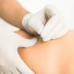What Can an Orthopedic Specialist Do for Me?