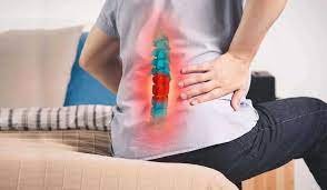 What Is a Discectomy?