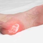 What Your Foot Doctor Can Do for Plantar Fasciitis and Other Conditions