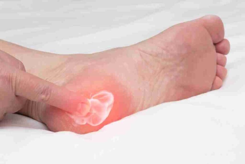 What Your Foot Doctor Can Do for Plantar Fasciitis and Other Conditions