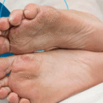 Why Podiatrists Are Essential in Preventing and Managing Foot Complications