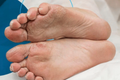 Why Podiatrists Are Essential in Preventing and Managing Foot Complications