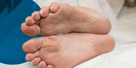 Why Podiatrists Are Essential in Preventing and Managing Foot Complications